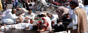 مقتل خمسة اشخاص واصابة 28 في انفجار قنبلة في بيشاور