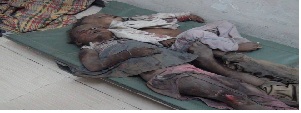 Saudi Massacre, Yemen, Taiz, Saudi-US coalition,  brutal aggression,Riyadh 