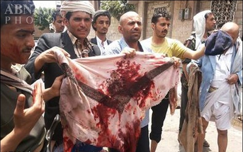 شلیک از فاصله نزدیک به انقلابیون یمن