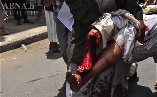 شلیک از فاصله نزدیک به انقلابیون یمن