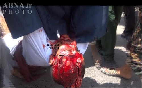 شلیک از فاصله نزدیک به انقلابیون یمن