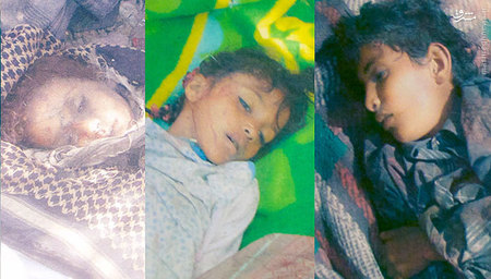(18+) تصاویر جنایات وحشیان آل سعود علیه کودکان یمنی