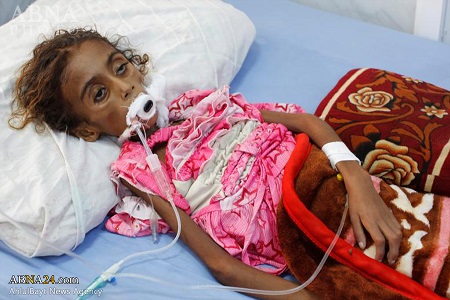 دختر ۷ ساله یمنی بر اثر شدت سوءتغذیه جان باخت