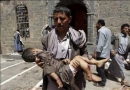 (18+) تصاویر جنایات حکومت کودک کش علیه کودکان یمنی